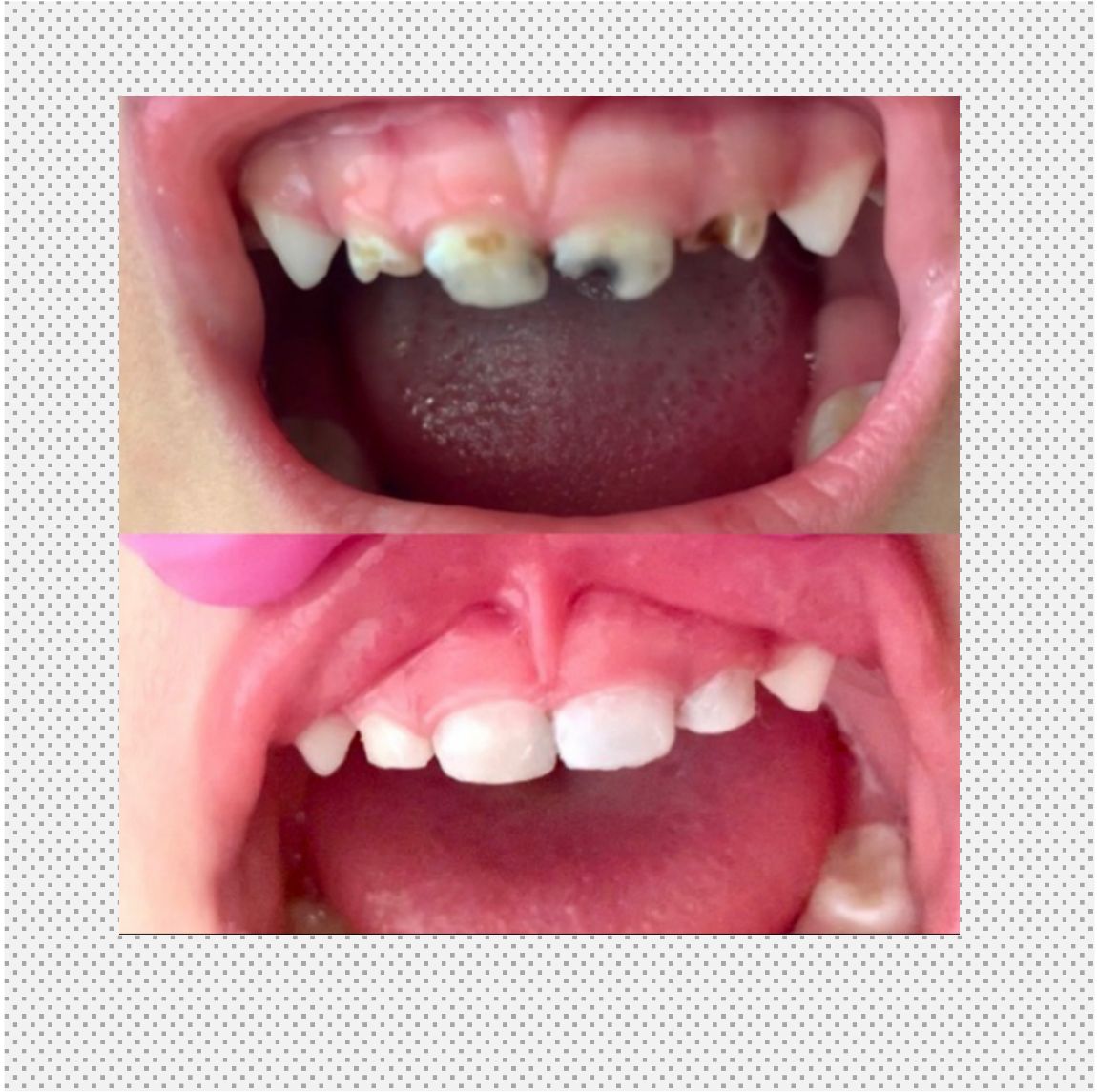 Odontopediatría