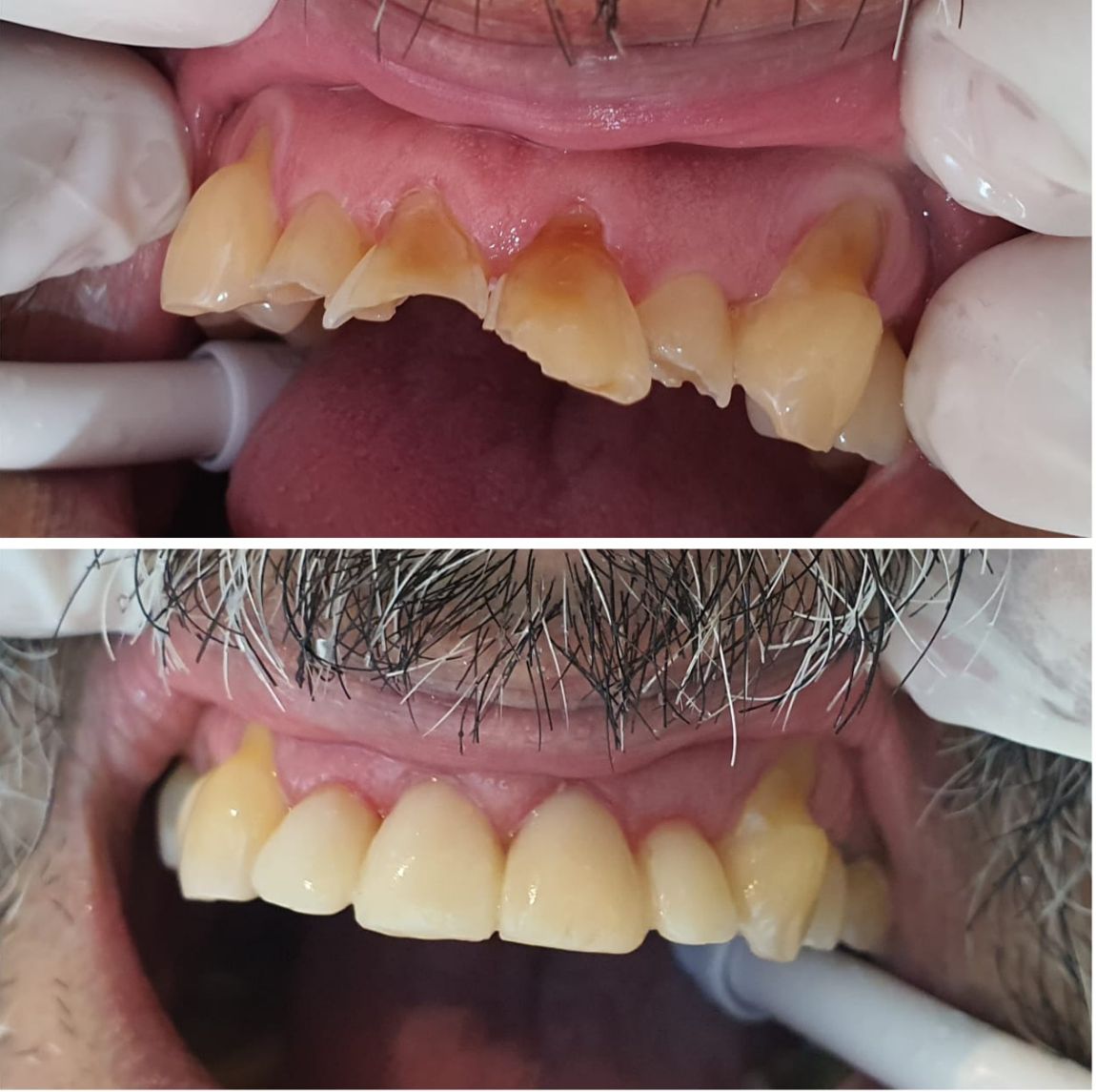 Operatoria dental