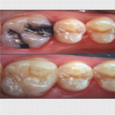 operatoria dental