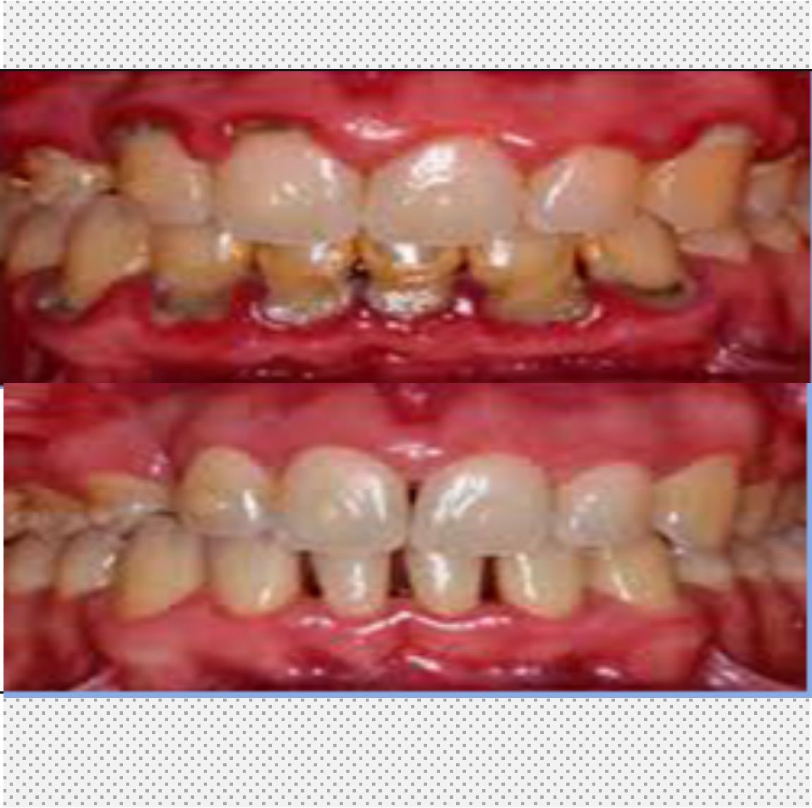 Periodoncia